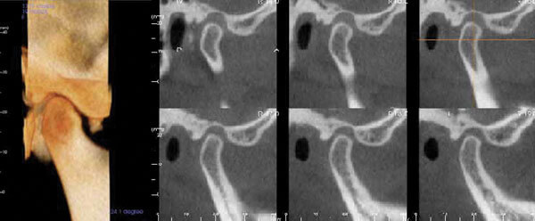 Patient with Jaw Pain