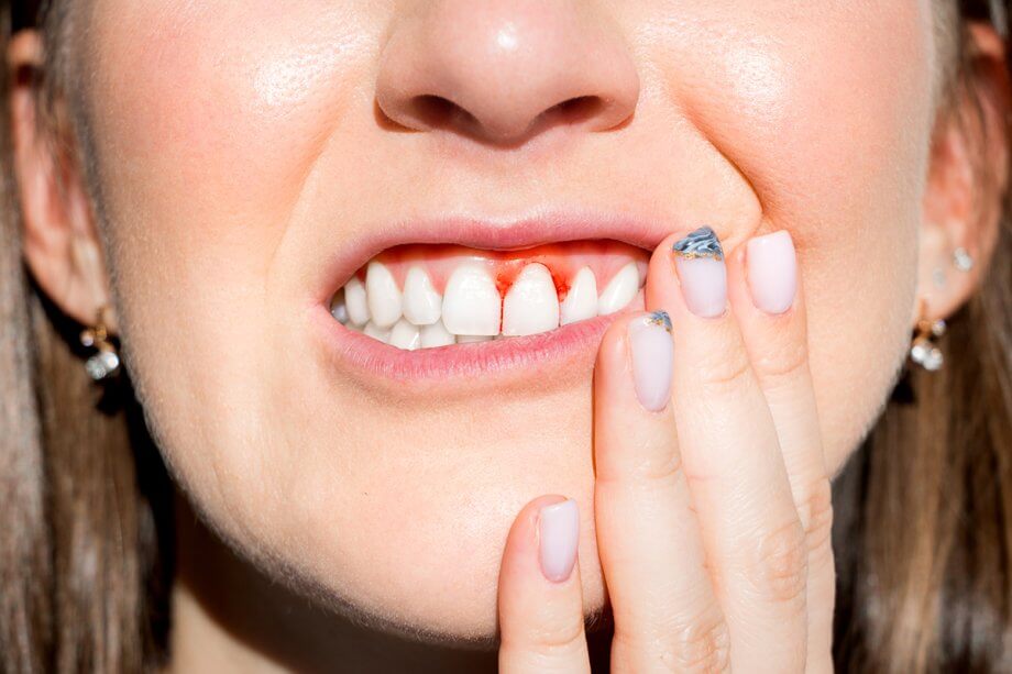 How Do You Treat Gum Disease?