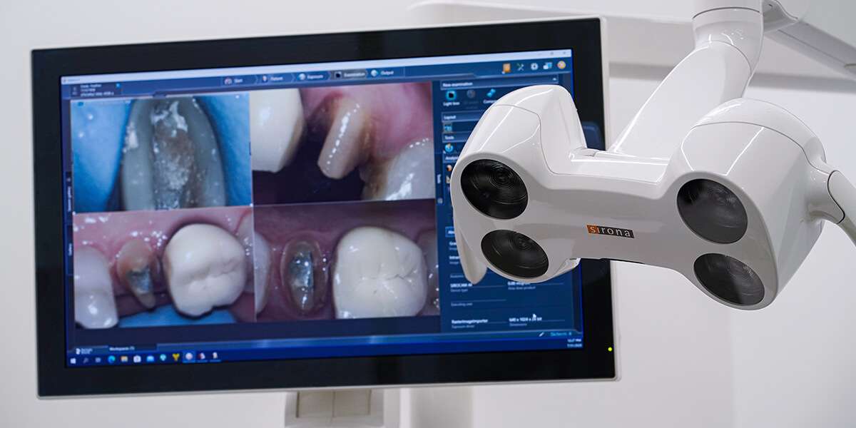 Restorative Dentistry - Smiling Man in Dental Chair